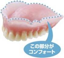 コンフォート（生体シリコン）義歯