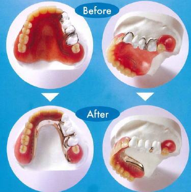 ミラクルデンチャー ミラクルデンチャー