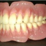 入れ歯は、夜作られる?