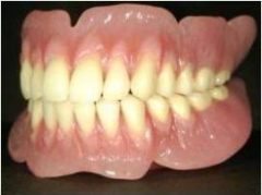 超精密入れ歯・義歯の作り方