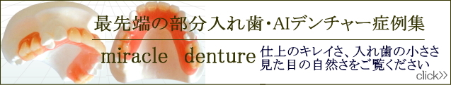 AIデンチャー症例集